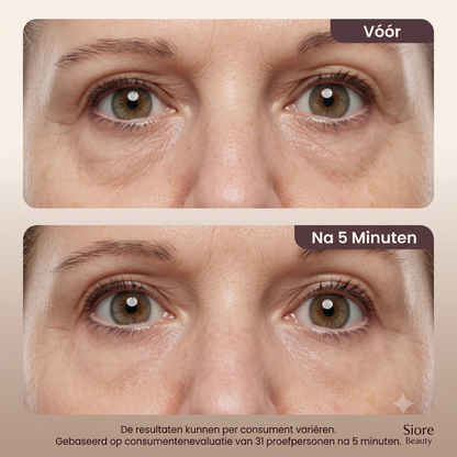 Sioré 5-Minute Eye Lift | Transformeer Je Blik Binnen 5 Minuten