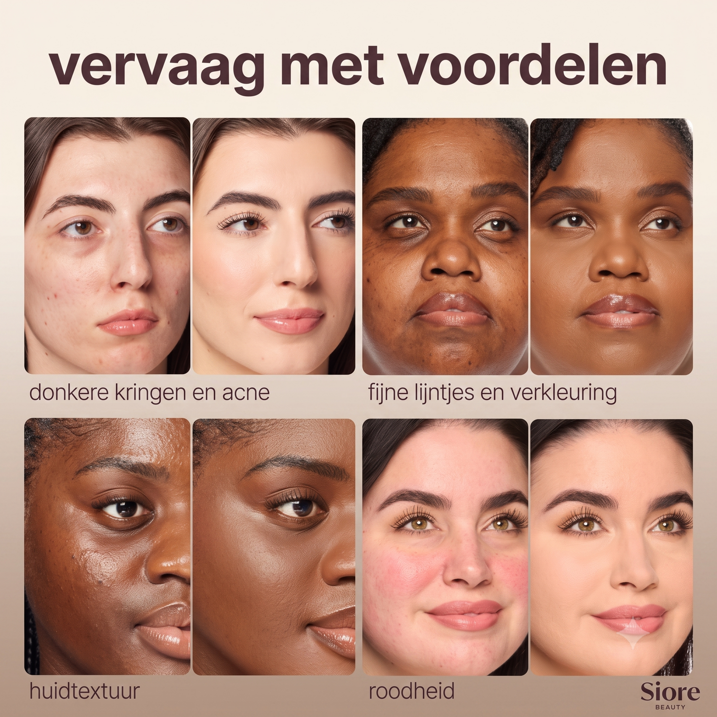 Sioré BB Blur Tint | #1 Vloeibare Filter Tint van Nederland (Incl. Gratis Kwast)