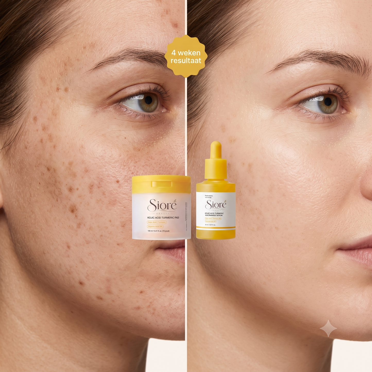 Siore - Kojic Acid Power Duo