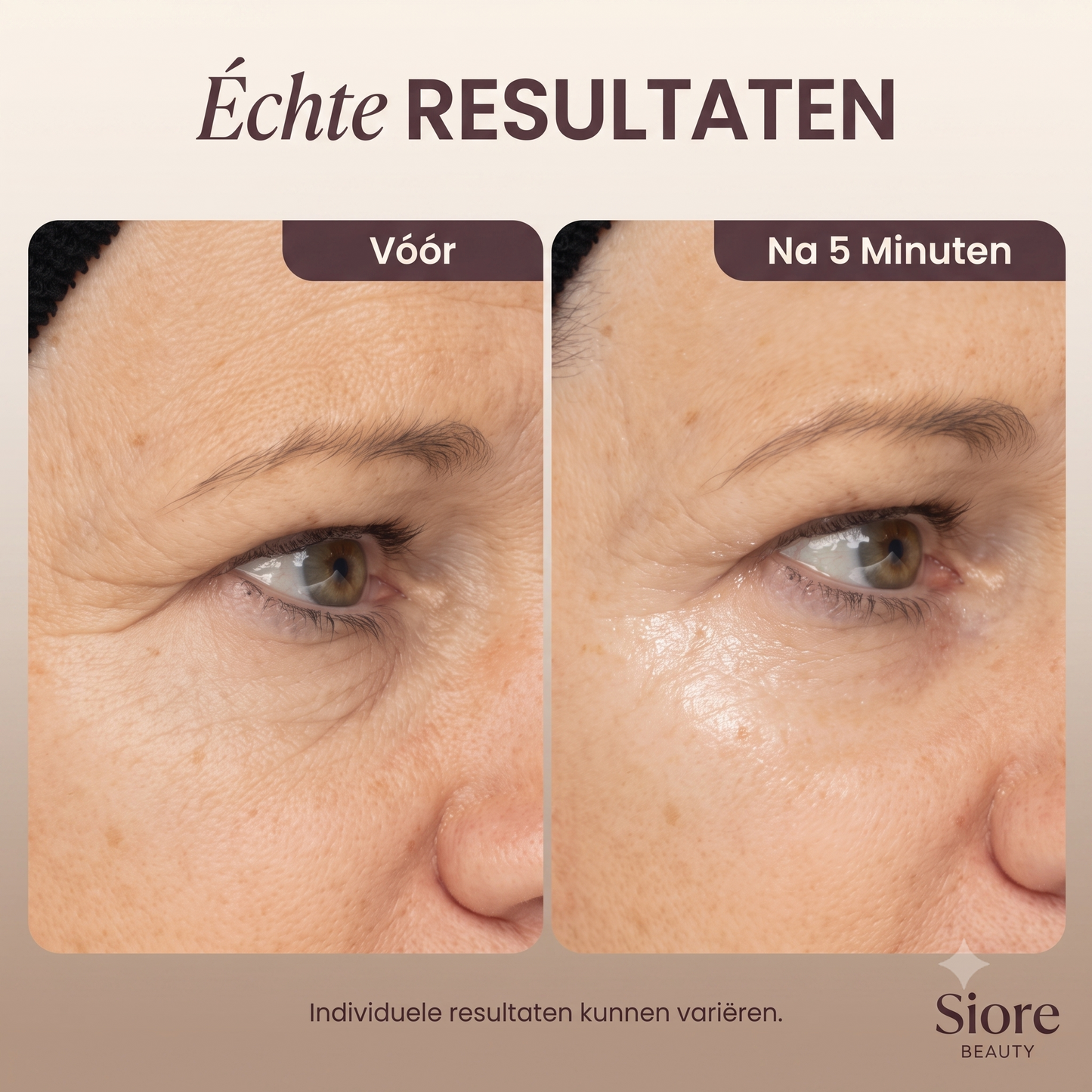 Sioré 5-Minute Eye Lift | Transformeer Je Blik Binnen 5 Minuten