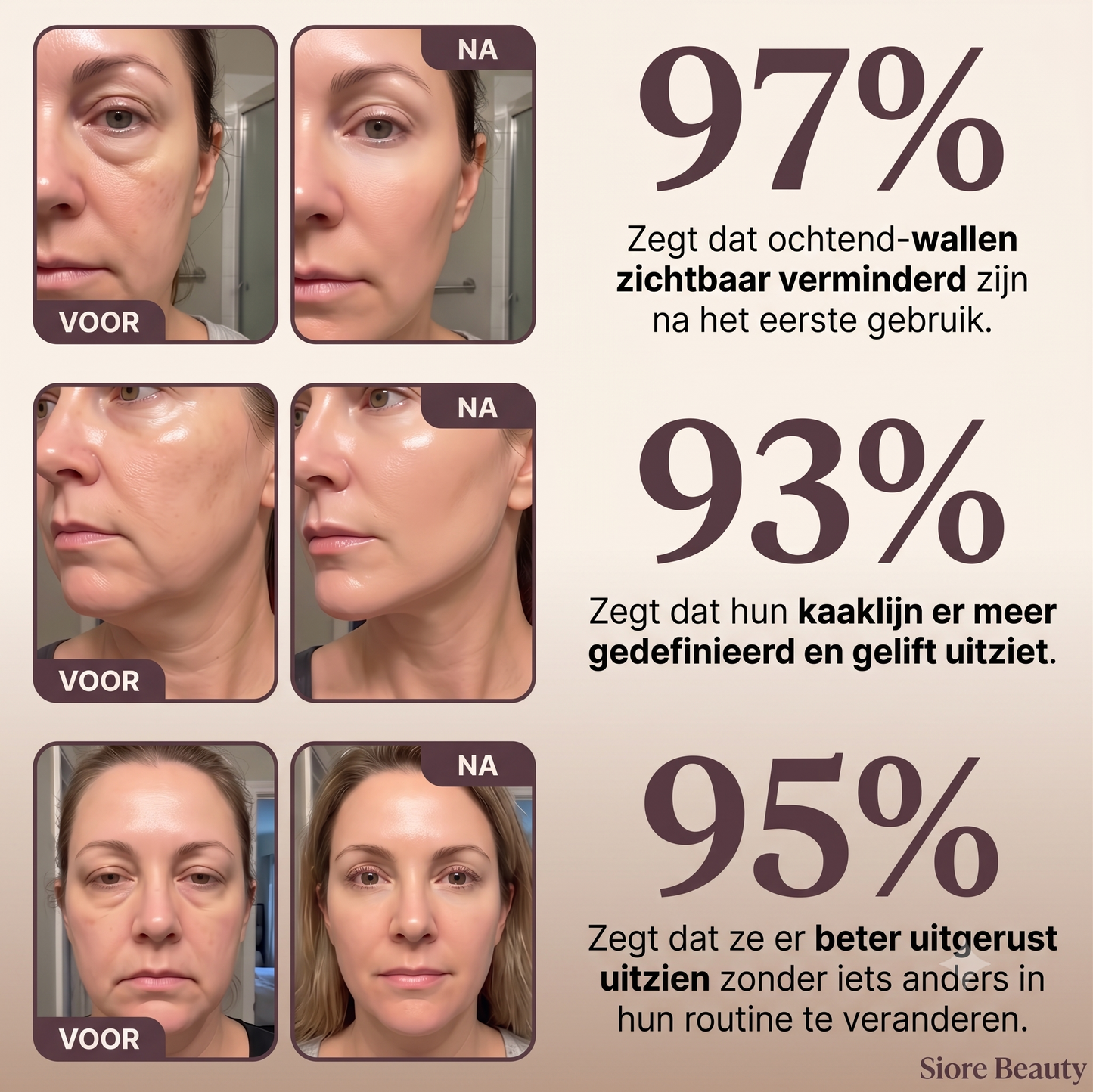 Sioré Anti-Aging Face Brush | Het 50+ Geheim Voor Een Strakke Kaaklijn