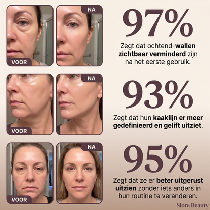 Sioré Anti-Aging Face Brush | Het 50+ Geheim Voor Een Strakke Kaaklijn